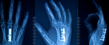 medical-mala medical-mala